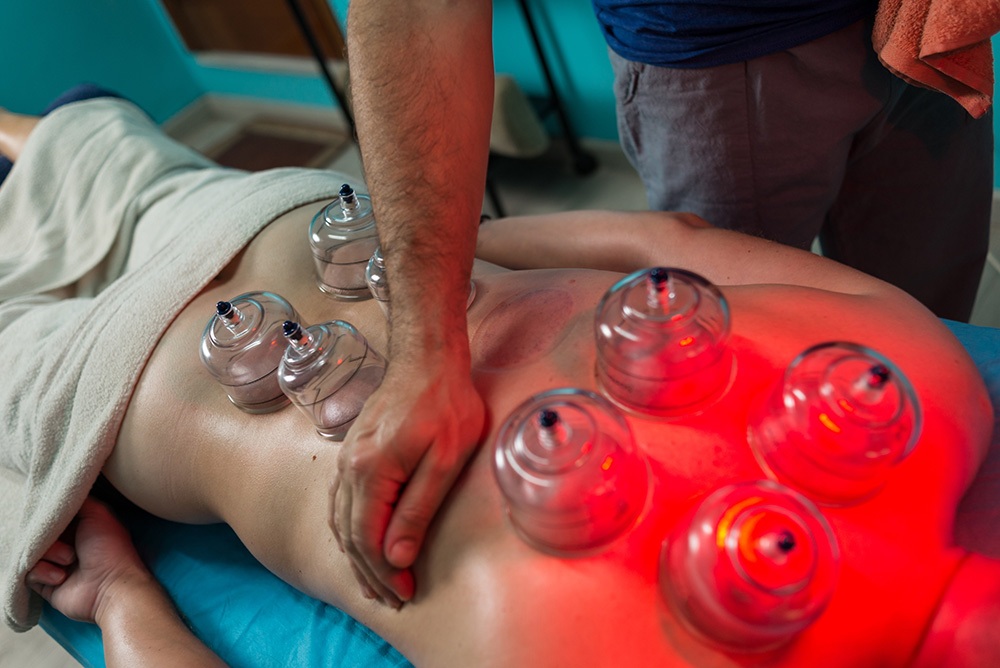 Vacuum cups sucking the skin of a patient