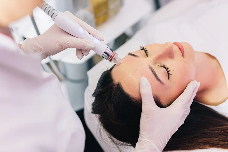 Close-up of hydrafacial treatment. Close-up of hydrafacial treatment.
